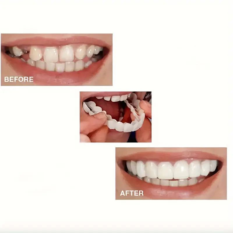 Adjustable Perfect Fit White Veneers